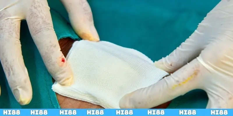 Mơ bắn bị thương những số may mắn bạn nên thử